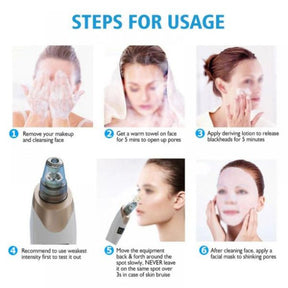 Blackhead Suction Remover Pore Vacuum | Blackhead Pore Cleaning Beauty Tool